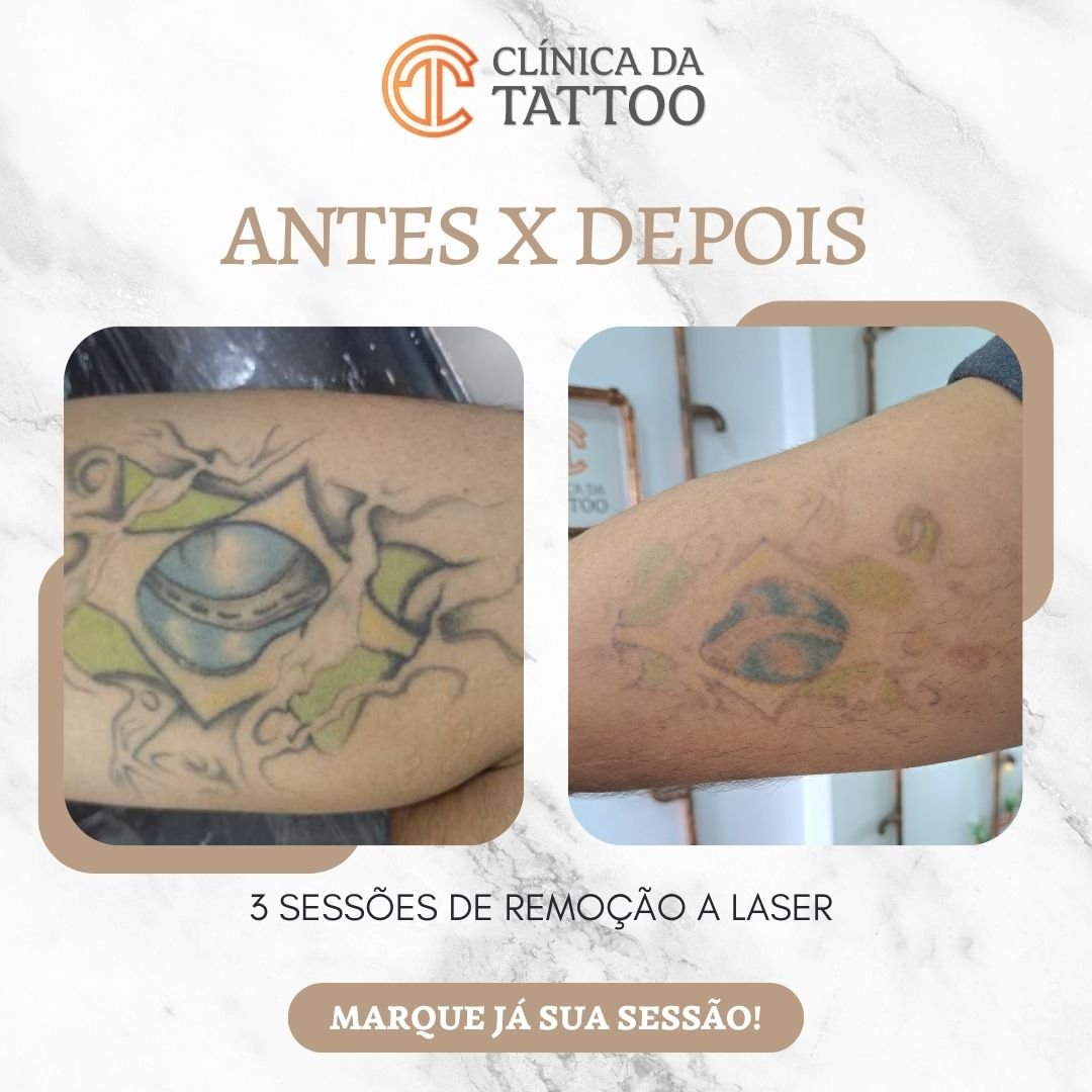Post Instagram Antes e Depois Reforma Decoração Branco Verde Minimalista